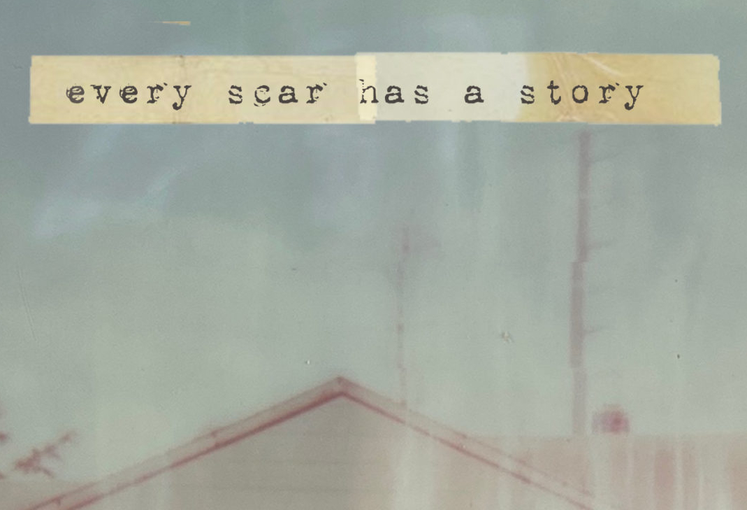 Every Scar Has A Story of 